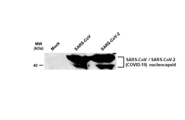 SARS-CoV/SARS-CoV-2 Nucleocapsid Antibody in Western Blot (WB)