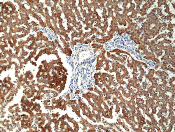 CPS1 Antibody in Immunohistochemistry (Paraffin) (IHC (P))