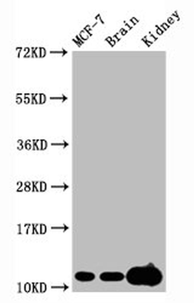 H4K20me3 Antibody in Western Blot (WB)