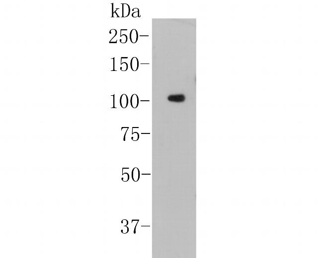 NFKB2 Antibody in Western Blot (WB)