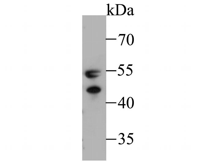 WARS Antibody in Western Blot (WB)