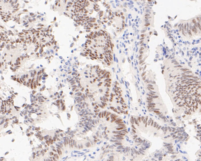 EHMT2 Antibody in Immunohistochemistry (Paraffin) (IHC (P))