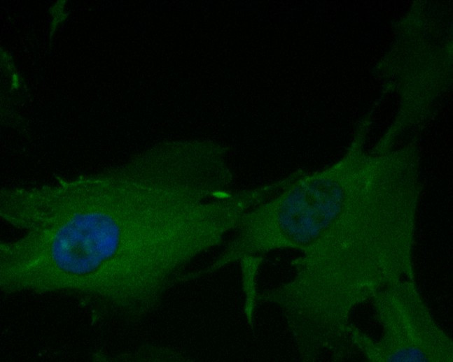 eIF3b Antibody in Immunocytochemistry (ICC/IF)