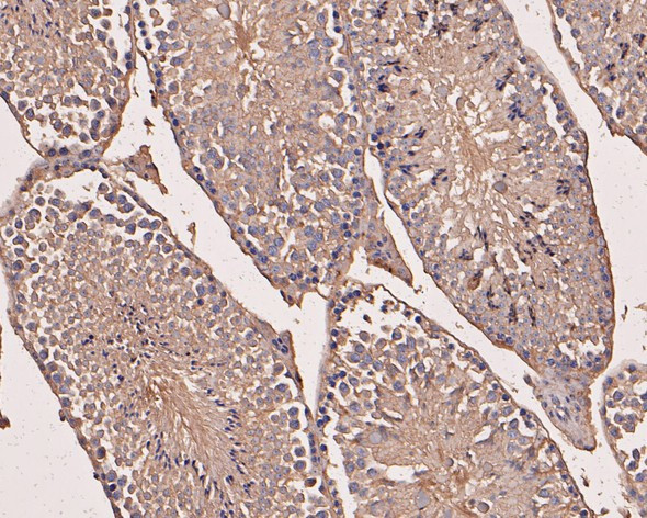 eIF3b Antibody in Immunohistochemistry (Paraffin) (IHC (P))