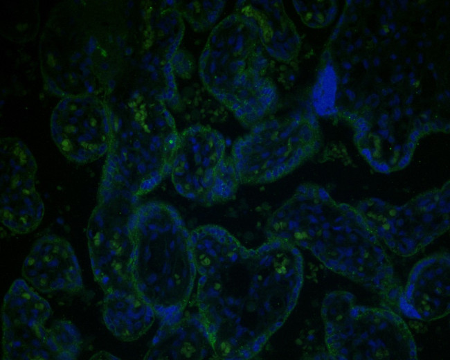 GAA Antibody in Immunohistochemistry (Paraffin) (IHC (P))