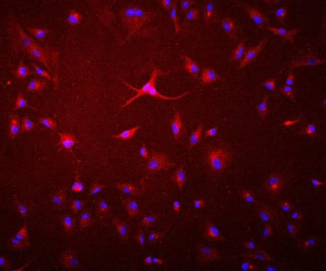 GAA Antibody in Immunocytochemistry (ICC/IF)