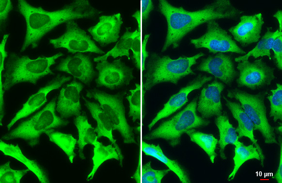 ACSL4/FACL4 Antibody in Immunocytochemistry (ICC/IF)