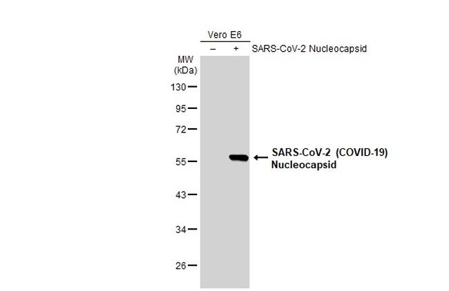 SARS-CoV-2 Nucleocapsid Antibody in Western Blot (WB)