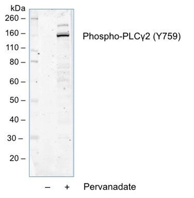 Phospho-PLCg2 (Tyr759) Antibody in Western Blot (WB)