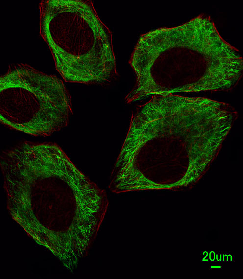 beta Tubulin Antibody in Immunocytochemistry (ICC/IF)