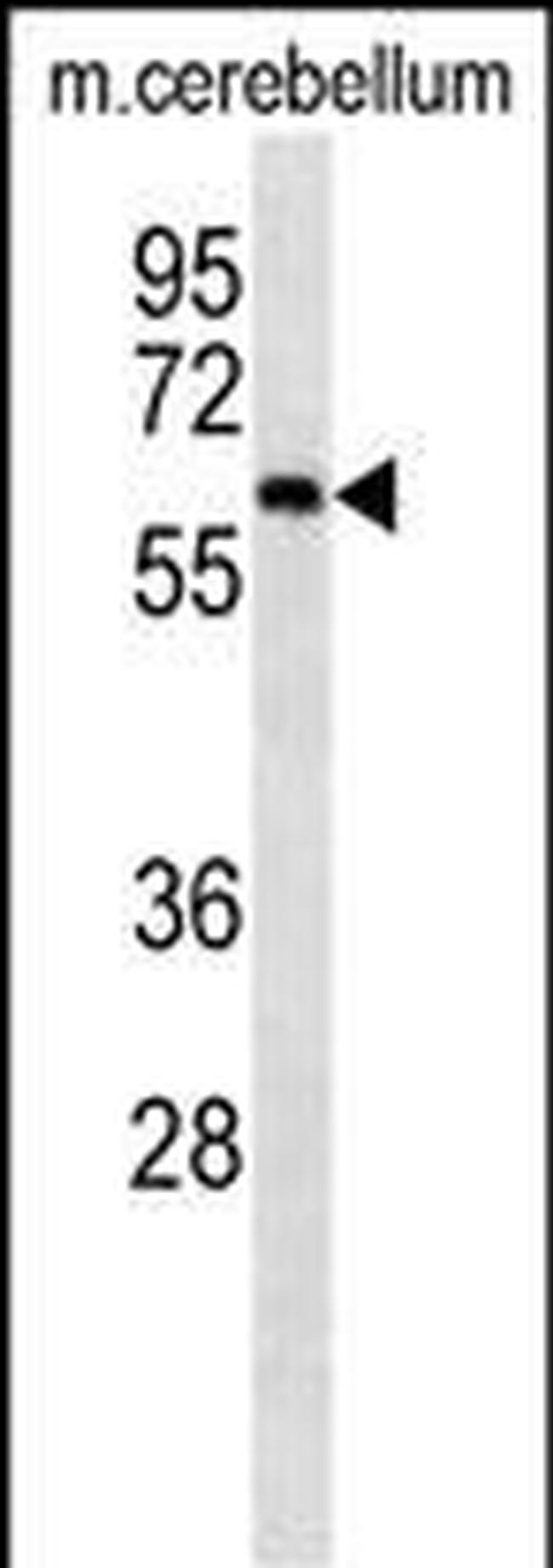 CAMKK2 Antibody in Western Blot (WB)