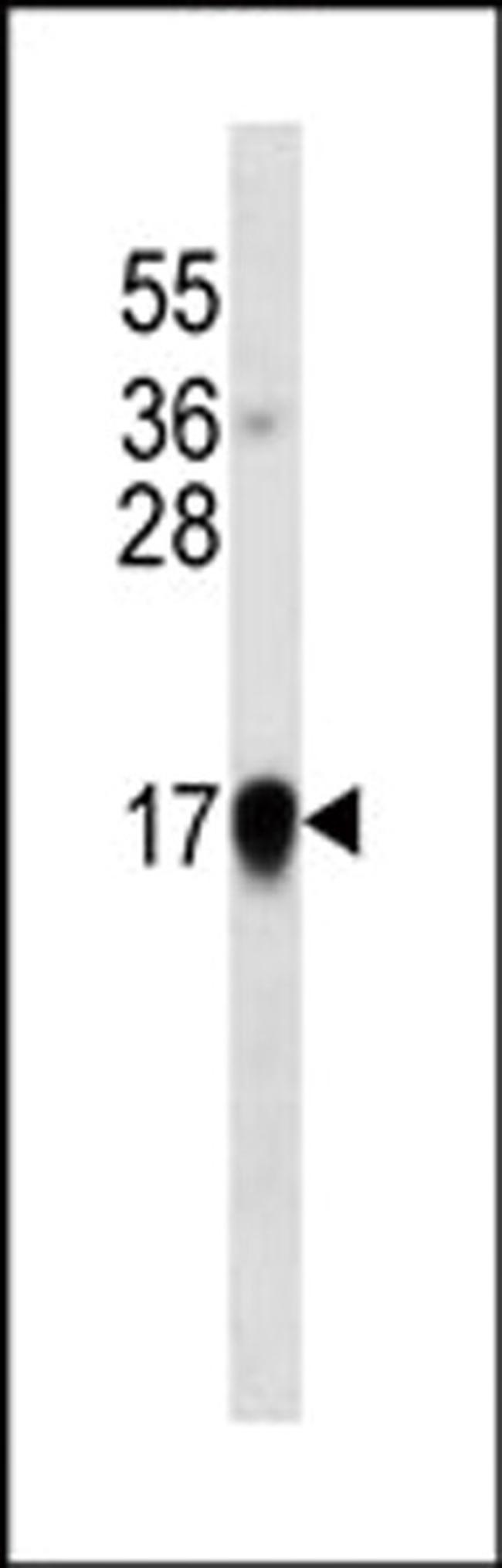 IFN alpha Antibody in Western Blot (WB)