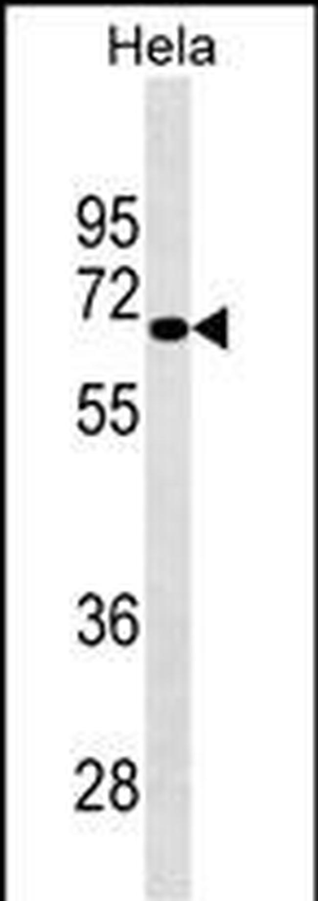 NUAK2 Antibody in Western Blot (WB)