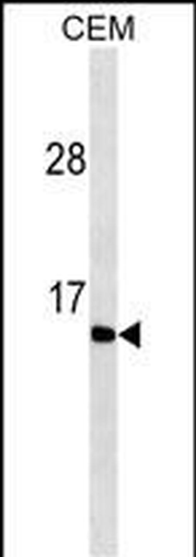 Gastrin Antibody in Western Blot (WB)