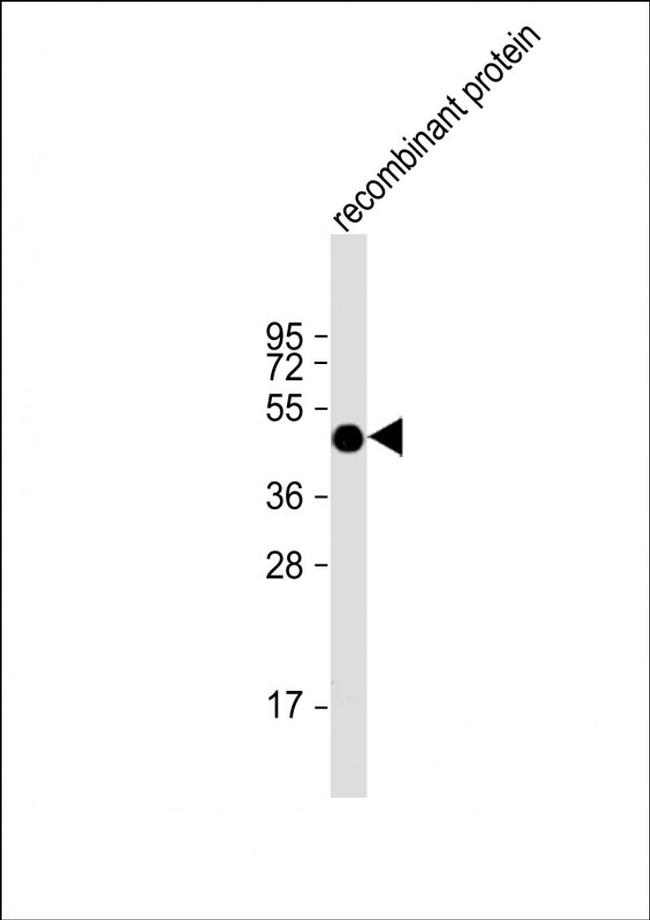 FAT1 Antibody in Western Blot (WB)