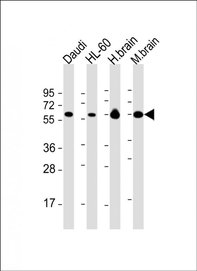 PACSIN2 Antibody in Western Blot (WB)