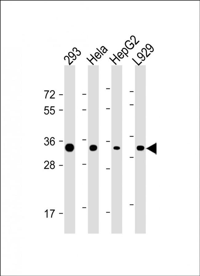 STUB1 Antibody in Western Blot (WB)