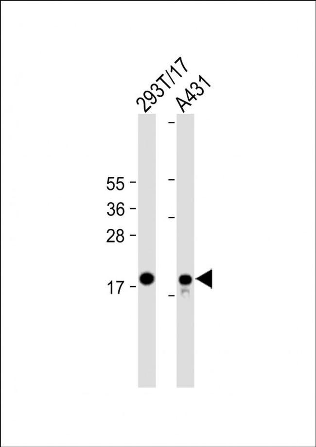 UBE2C Antibody in Western Blot (WB)