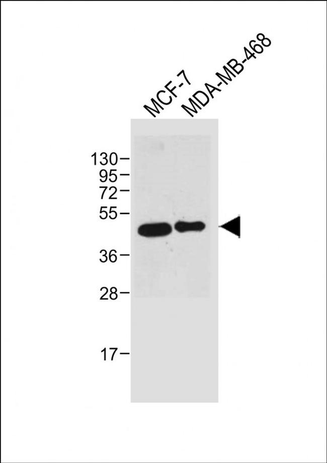 SULT2B1 Antibody in Western Blot (WB)