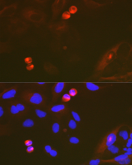 TACC3 Antibody in Immunocytochemistry (ICC/IF)