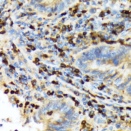 TACC3 Antibody in Immunohistochemistry (Paraffin) (IHC (P))