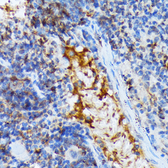 TACC3 Antibody in Immunohistochemistry (Paraffin) (IHC (P))