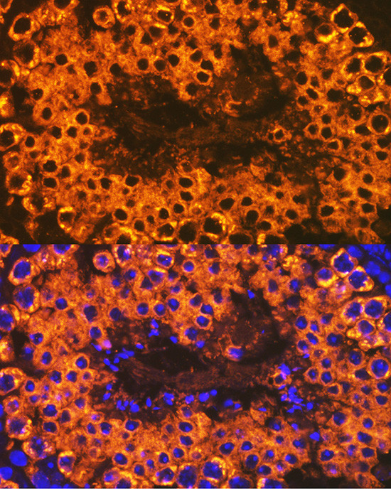 CLGN Antibody in Immunocytochemistry (ICC/IF)