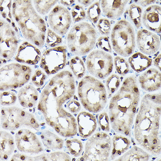 Ubiquitin Antibody in Immunohistochemistry (Paraffin) (IHC (P))