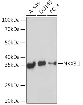 Nkx3.1 Antibody in Western Blot (WB)