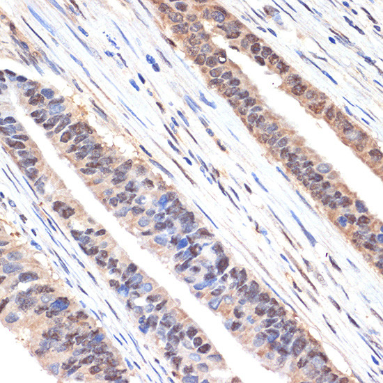 SESN1 Antibody in Immunohistochemistry (Paraffin) (IHC (P))