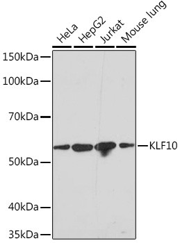 KLF10 Antibody in Western Blot (WB)