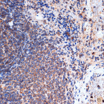 FNTB Antibody in Immunohistochemistry (Paraffin) (IHC (P))