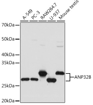 PHAPI2 Antibody in Western Blot (WB)