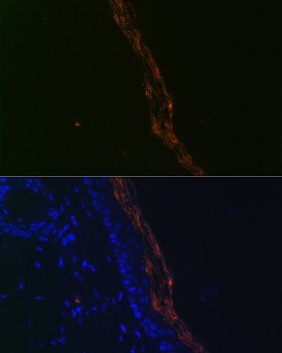 PERP Antibody in Immunocytochemistry (ICC/IF)