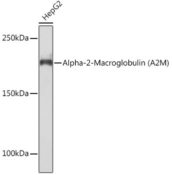 A2M Antibody in Western Blot (WB)