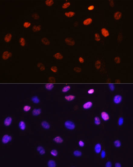 Phospho-c-Jun (Ser63) Antibody in Immunocytochemistry (ICC/IF)