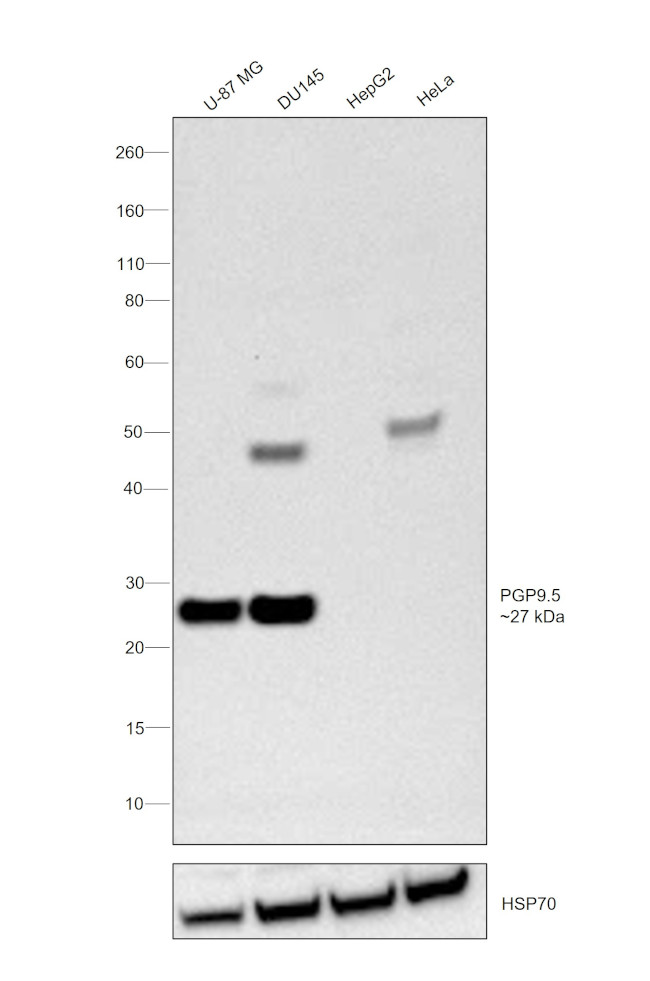 PGP9.5 Antibody in Western Blot (WB)