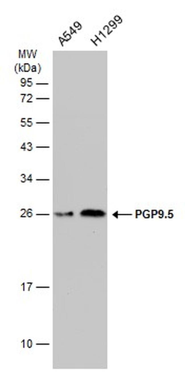 PGP9.5 Antibody in Western Blot (WB)