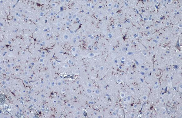 IBA1 Antibody in Immunohistochemistry (Paraffin) (IHC (P))