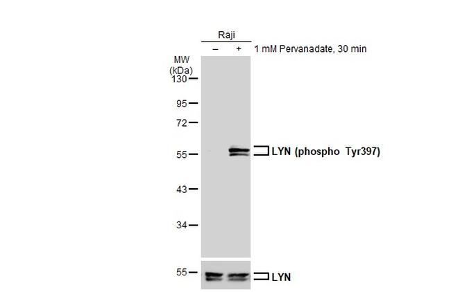 Phospho-Lyn (Tyr397) Antibody in Western Blot (WB)
