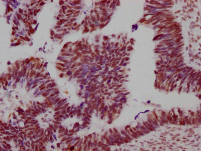 SMC1 Antibody in Immunohistochemistry (Paraffin) (IHC (P))