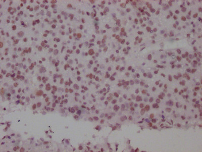 SMC1 Antibody in Immunohistochemistry (Paraffin) (IHC (P))