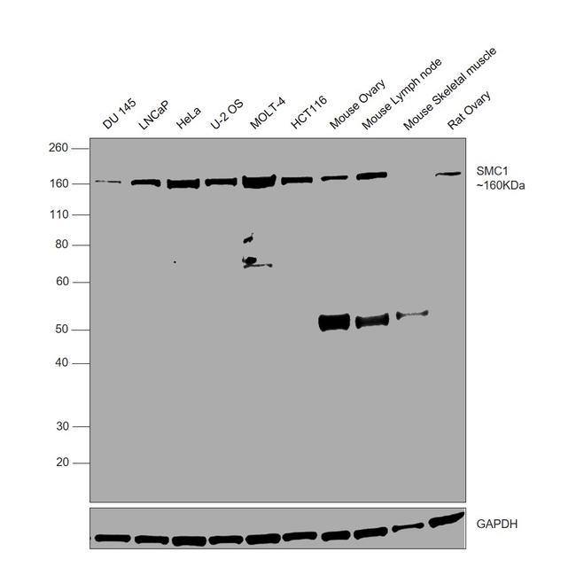 SMC1 Antibody in Western Blot (WB)