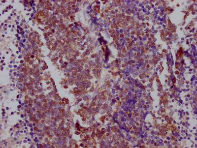 Nkx2.1 Antibody in Immunohistochemistry (Paraffin) (IHC (P))