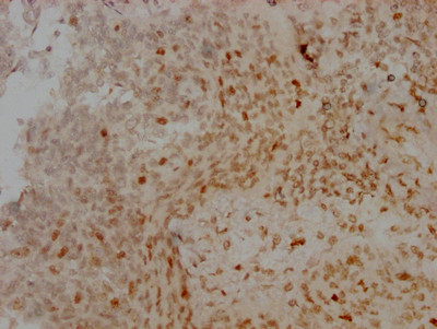 Aurora B Antibody in Immunohistochemistry (Paraffin) (IHC (P))