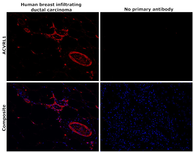 ACVRL1 Antibody in Immunohistochemistry (Paraffin) (IHC (P))