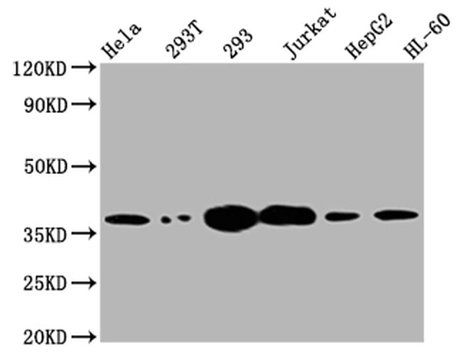 Thymidylate Synthase Antibody in Western Blot (WB)