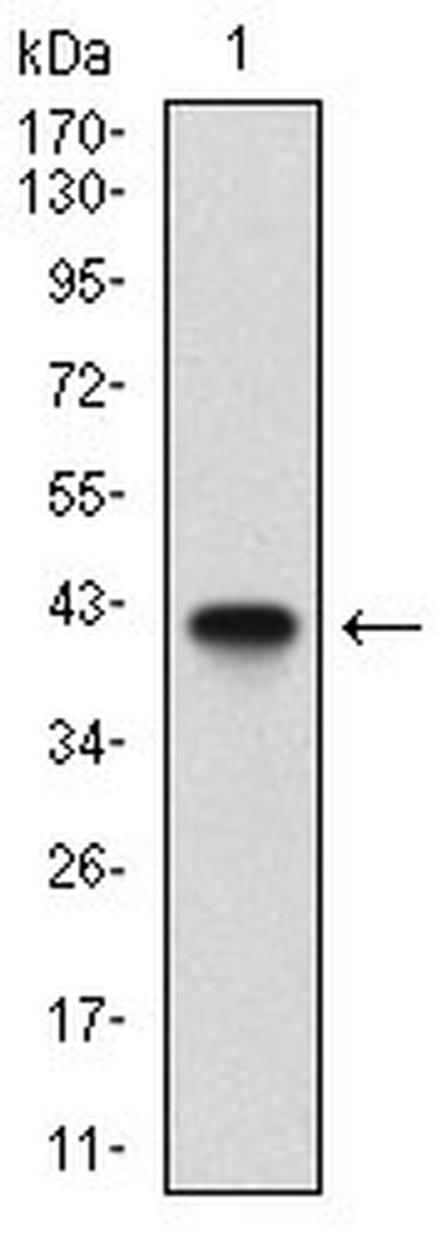 beta-2 Microglobulin Antibody in Western Blot (WB)