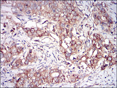 PKR Antibody in Immunohistochemistry (Paraffin) (IHC (P))