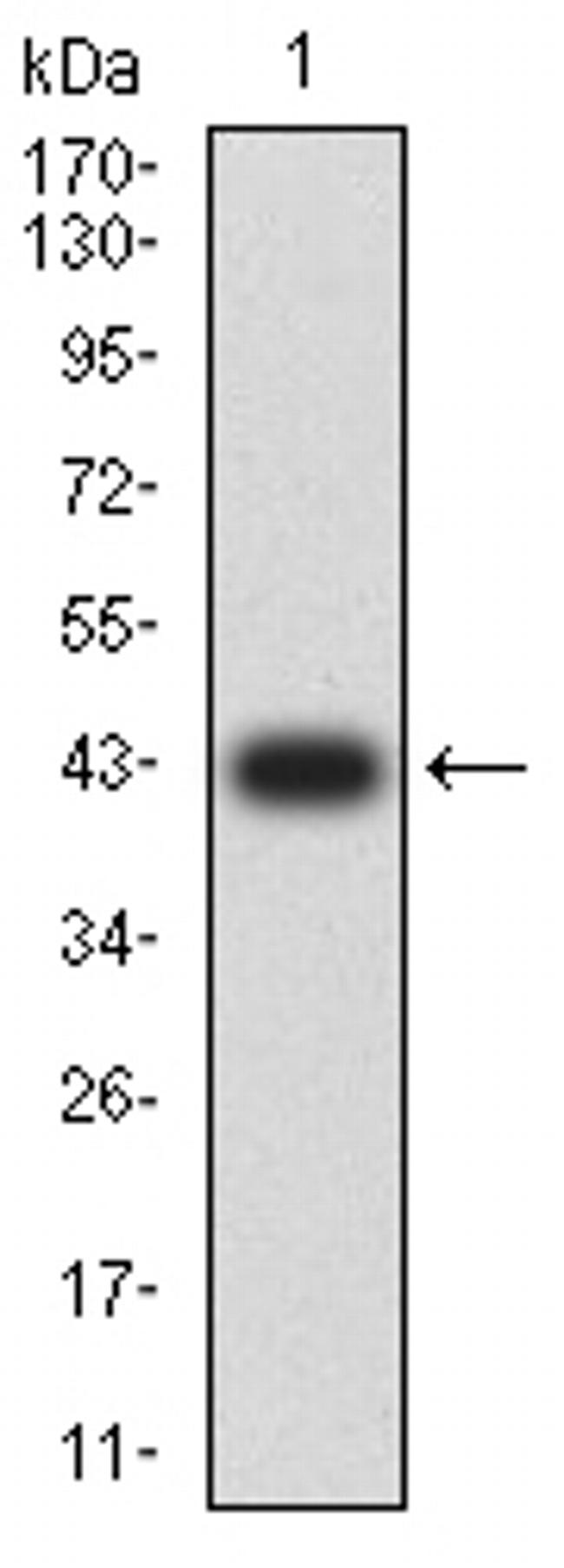 FSHR Antibody in Western Blot (WB)